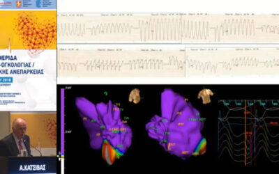 Αρρυθμιογόνος καρδιά και κοιλιακή ταχυκαρδία - Απόστολος Κατσίβας Αρρυθμιογόνος καρδιά και κοιλιακή ταχυκαρδία - Απόστολος Κατσίβας