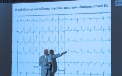 Ηλεκτροφυσιολογική διαφορική διάγνωση υπερκοιλιακών ταχυκαρδιών - Απόστολος-Κατσίβας Ηλεκτροφυσιολογική διαφορική διάγνωση υπερκοιλιακών ταχυκαρδιών - Απόστολος-Κατσίβας